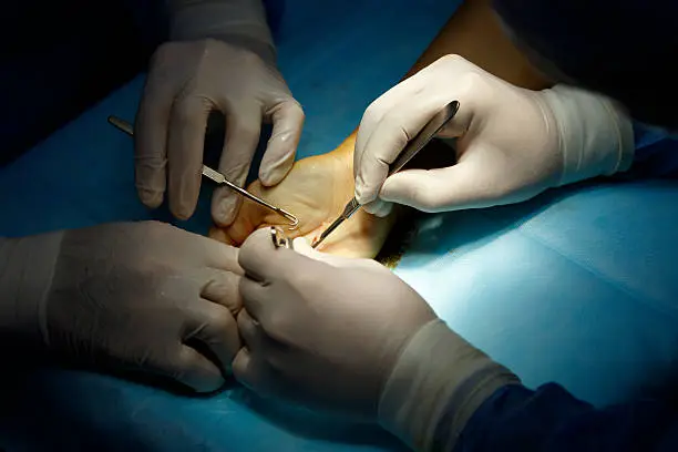 When Is Hand Surgery Necessary?
