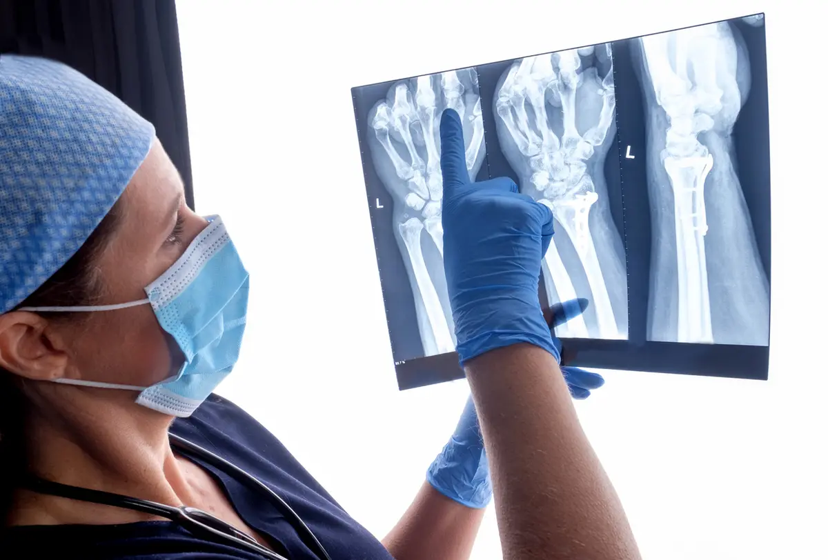Hand Surgery: Overview for Patients