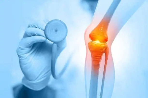 Knee Replacement Revision Specialist: A Step-by-Step Guide