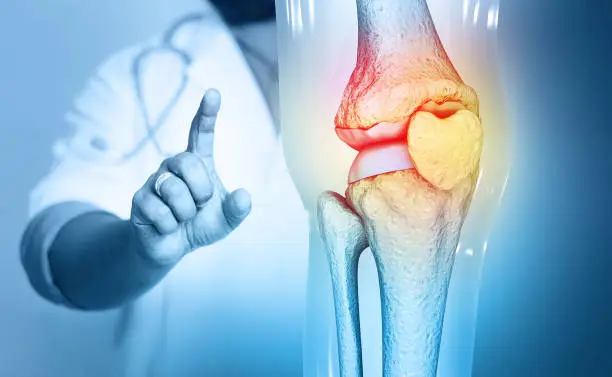 Knee Treatment: A Step-by-Step Guide