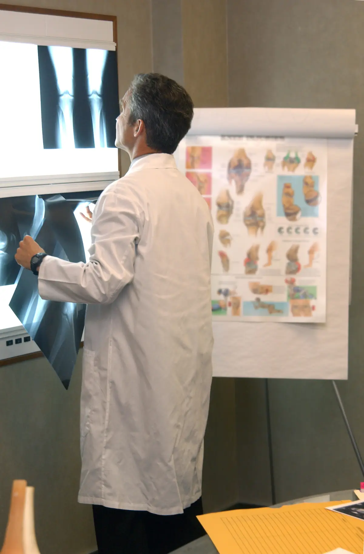 Orthopedic Surgeons Who Deal with Lower Limbs