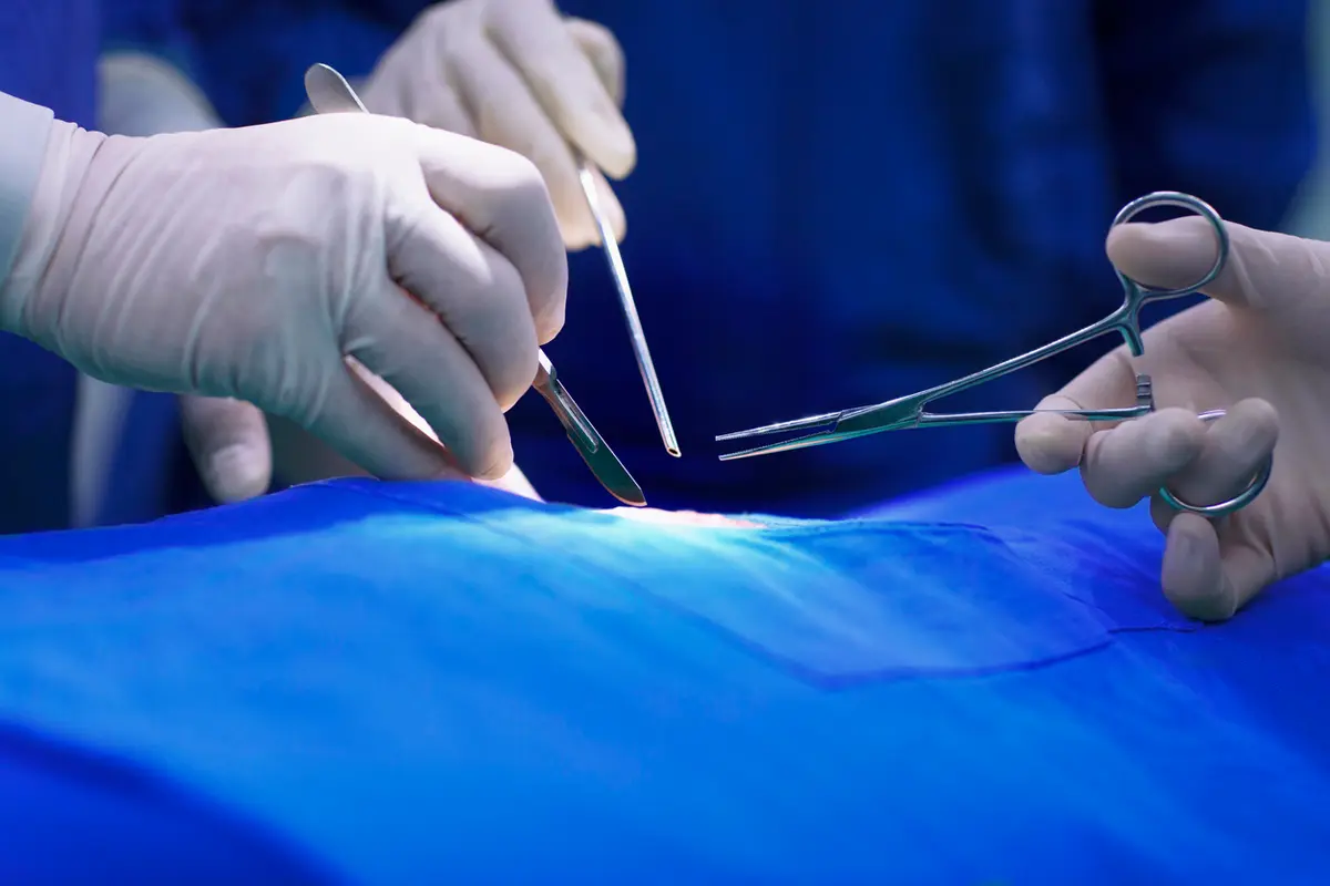 Steps of Hand Surgery Procedure