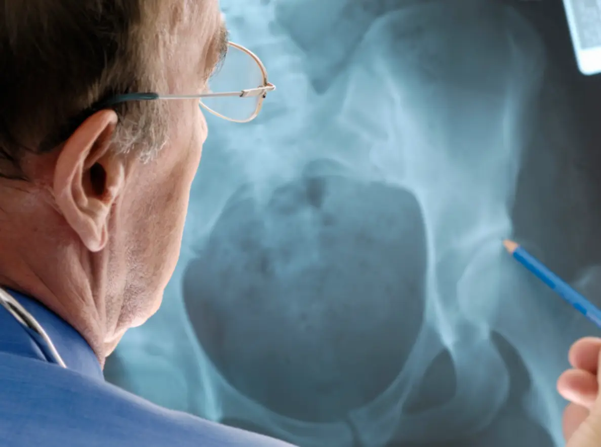 Tips For Hip Replacement Success