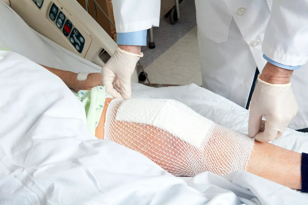 What is Knee Replacement Surgery?