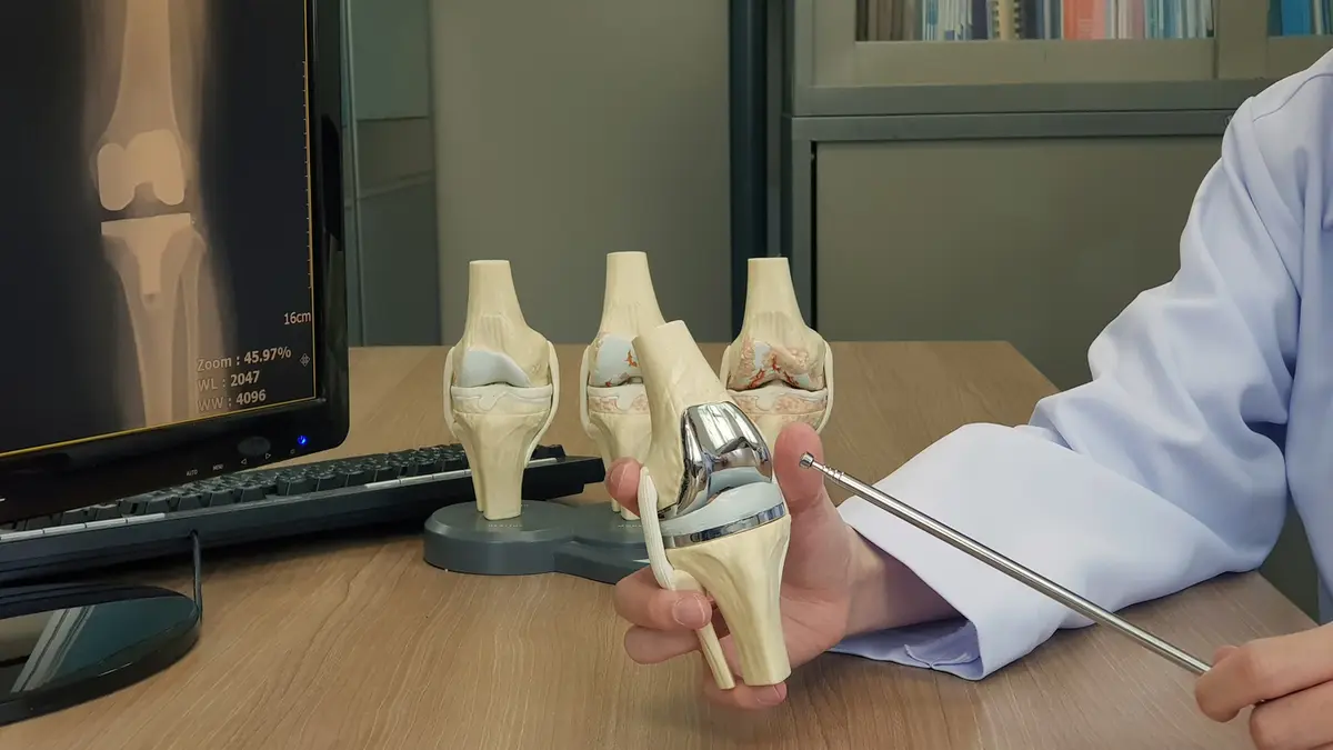 When Should You Consider a Knee Revision Surgery?
