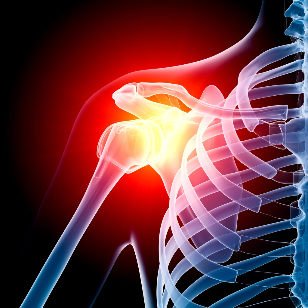 Shoulder Arthroscopic Repairs