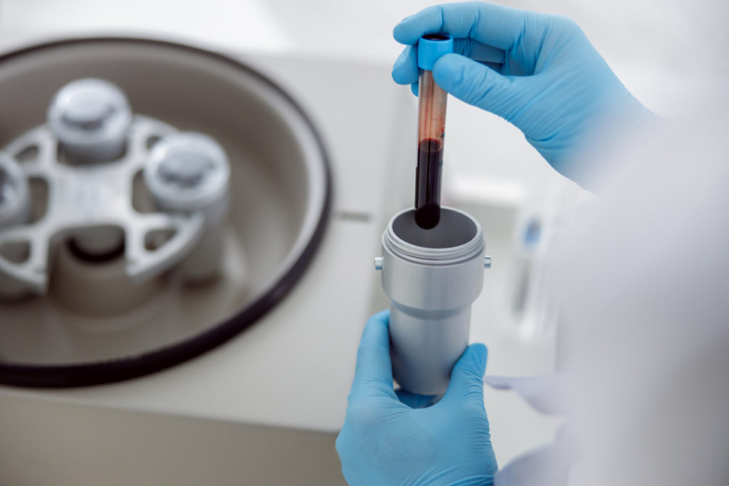 Lab woman putting in centrifuge tube of blood