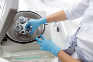 Top view of plazmolifting in a beauty salon