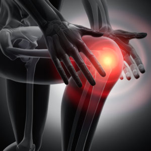 Image of knee pain