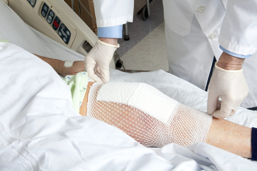 A patient getting their knee bandaged after a Knee Arthroplasty.