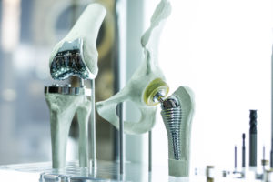 A prosthetic knee that will be used in a patient's knee replacement surgery.