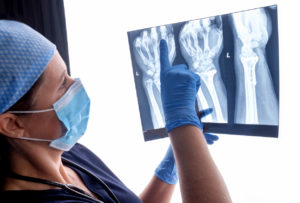 orthopaedic surgeon looking at x-ray after Hand surgery