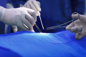 orthopedic doctors performing hand surgery in hospital operating room