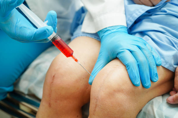 Asian doctor inject Hyaluronic acid platelet rich plasma into the knee of senior woman to walk without pain.