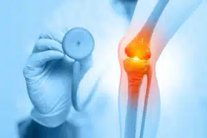 knee replacement revision specialist examining human knee joints. Osteoarthritis, rheumatoid arthritis, joint disease. Knee Joint and bone treatment. 3d illustration