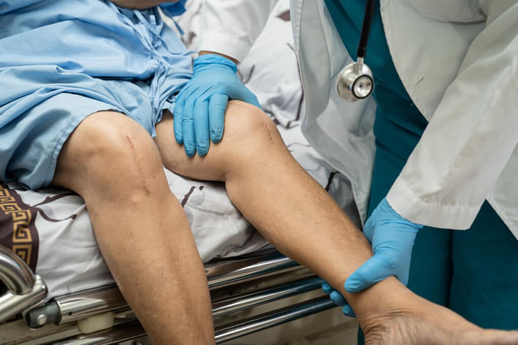 surgeon checking patient after knee replacement