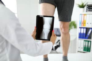 A picture of an orthopedic knee specialist holding a tablet showing a knee X-ray near a patient's leg in the clinic, close-up.