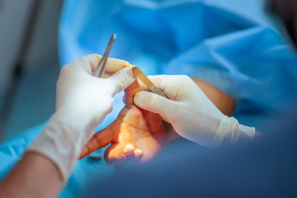 An orthopedic hand specialist is holding the patient’s hand during a hand surgery procedure.