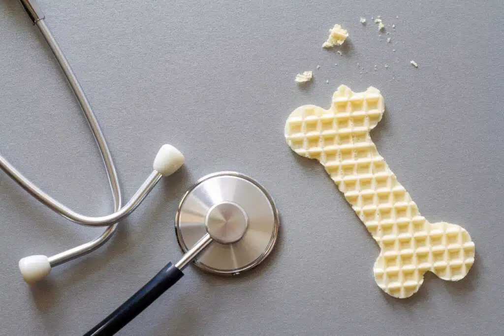 A creative concept where a bone-shaped waffle alongside a stethoscope symbolizes fragile, brittle bones represents osteoporosis.