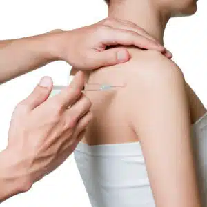 A man is administering a trigger point injection (TPI) into the bare shoulder of a woman using a syringe.