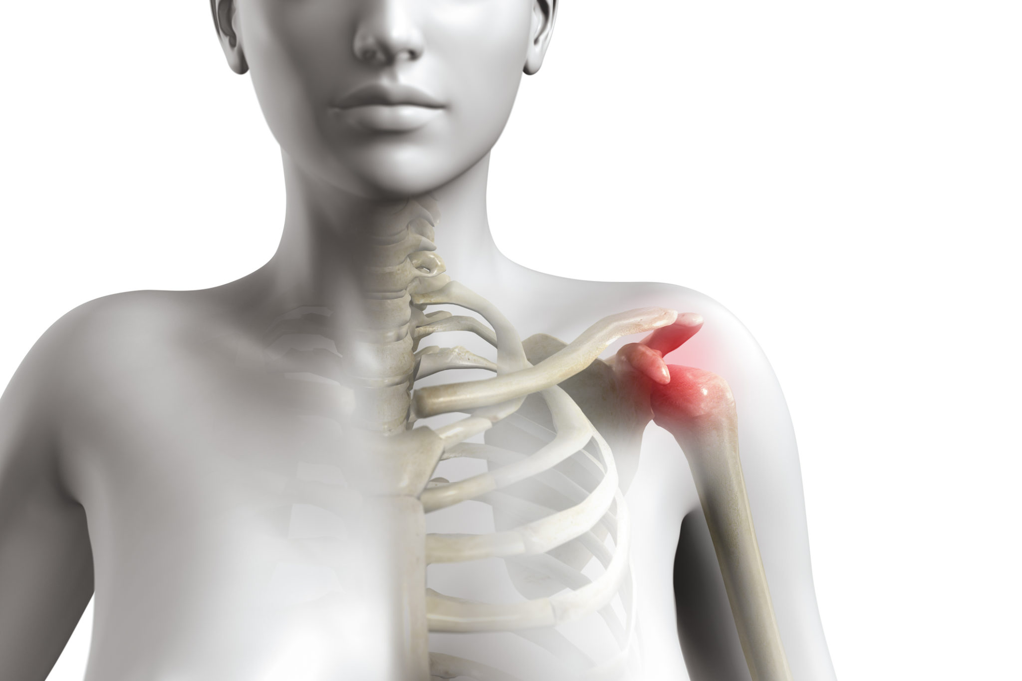 shoulder muscles pain